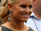 Jessica Simpson: Botox?