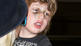 Woher hat Max das blaue Auge?