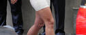 Top-Figur und trotzdem Cellulite